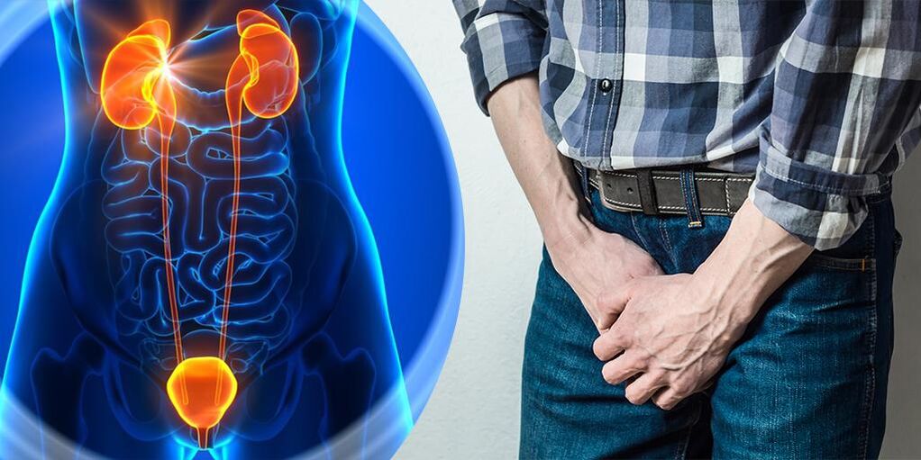 Inflamarea prostatei
