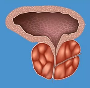 Trăsăturile caracteristice ale prostatitei