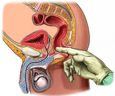 Examinarea prostatei degetelor