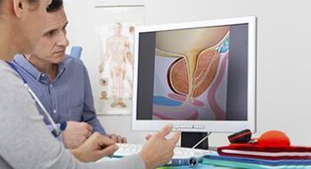 diagnosticarea prostatitei la un bărbat