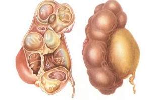 Veziculelor